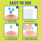 Cutter Bug Bite Patches Itch Relief Hydrocolloid Patches for Kids & Adults, Absorbs Fluids, Helps Heal, Prevents Scratching, Mosquito Itch Relief, Hydrocortisone & Suction Tool Alternative, 51 Count